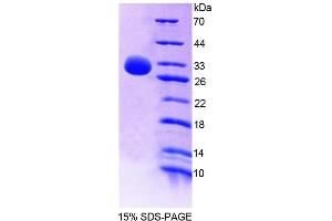 SDS-PAGE (SDS) image for Nuclear Receptor Subfamily 0, Group B, Member 2 (NR0B2) (AA 1-260) protein (His tag) (ABIN4989108)