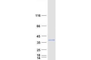 Western Blotting (WB) image for Protein Phosphatase, Mg2+/Mn2+ Dependent, 1L (PPM1L) protein (Myc-DYKDDDDK Tag) (ABIN2729816)