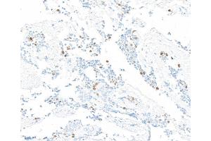 Immunohistochemistry (IHC) image for anti-Cyclin A2 (CCNA2) (C-Term) antibody (ABIN7795812) (Rekombinanter Cyclin A Antikörper  (C-Term))