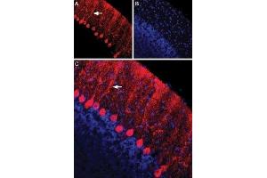 Expression of Nectin-1 in rat cerebellumImmunohistochemical staining of immersion-fixed, free floating rat brain frozen sections using Anti-Nectin-1/PVRL1 (extracellular) Antibody (ABIN7043440, ABIN7044692 and ABIN7044693), (1:100). (Poliovirus Receptor-Related 1 (Herpesvirus Entry Mediator C) (PVRL1) Peptid)