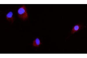 IF analysis of Beta 2 Microglobulin/B2m using anti-Beta 2 Microglobulin/B2m antibody (ABIN7600594). (beta-2 Microglobulin Antikörper  (AA 21-119))
