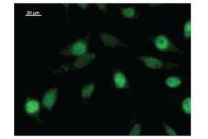 Immunostaining analysis in HeLa cells. (ZNF384 Antikörper)
