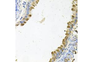 Immunohistochemistry of paraffin-embedded mouse lung using KLK11 antibody (ABIN6129404, ABIN6142947, ABIN6142949 and ABIN6222337) at dilution of 1:100 (40x lens). (Kallikrein 11 Antikörper  (AA 1-250))