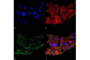 Immunocytochemistry/Immunofluorescence analysis using Rabbit Anti-ATG7 Polyclonal Antibody . (ATG7 Antikörper  (N-Term) (Biotin))