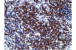 Immunohistochemical staining of paraffin-embedded Human lymph node tissue using anti-PIK3AP1 mouse monoclonal antibody. (PIK3AP1 Antikörper)