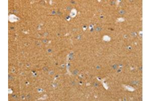The image on the left is immunohistochemistry of paraffin-embedded Human brain tissue using ABIN7191634(NFASC Antibody) at dilution 1/30, on the right is treated with synthetic peptide. (NFASC Antikörper)