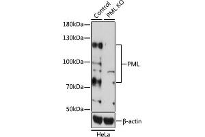 Western blot analysis of extracts from normal (control) and PML knockout (KO) HeLa cells, using PML antibody (ABIN3021658, ABIN3021659, ABIN3021660, ABIN1513388 and ABIN1514534) at 1:1000 dilution. (PML Antikörper  (AA 300-600))