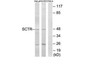 Western blot analysis of extracts from HeLa/HuvEc cells, using SCTR Antibody.