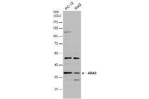 WB Image Various whole cell extracts (30 μg) were separated by 10% SDS-PAGE, and the membrane was blotted with ARA9 antibody [N1C3] , diluted at 1:500.