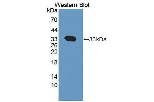 WB of Protein Standard: different control antibodies against Highly purified E.