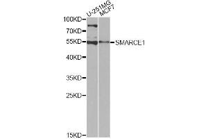 Western blot analysis of extracts of various cell lines, using SMARCE1 antibody (ABIN6290090) at 1:1000 dilution. (SMARCE1 Antikörper)