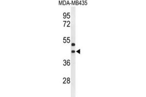 Western Blotting (WB) image for anti-G Protein-Coupled Receptor 17 (GPR17) antibody (ABIN3004347) (GPR17 Antikörper)