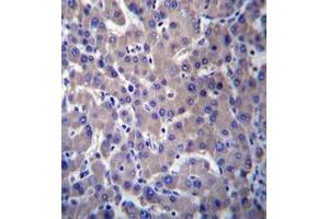 Immunohistochemistry analysis in human liver tissue (formalin-fixed, paraffin-embedded) using GPR34  Antibody , followed by peroxidase conjugation of the secondary antibody and DAB staining. (GPR34 Antikörper  (Middle Region))