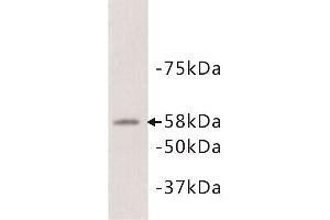 Western Blotting (WB) image for anti-Alkaline Phosphatase (ALP) antibody (ABIN1854820) (Alkaline Phosphatase Antikörper)