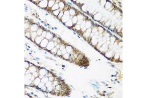 Immunohistochemistry of paraffin-embedded human colon using NCBP2 antibody. (NCBP2 Antikörper  (AA 1-156))