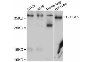 Western blot analysis of extracts of various cell lines, using CLEC1A antibody (ABIN5997458) at 1/1000 dilution. (CLEC1A Antikörper)