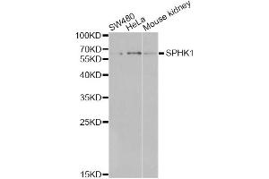 Western blot analysis of extracts of various cell lines, using SPHK1 antibody (ABIN6290942) at 1:1000 dilution. (SPHK1 Antikörper)