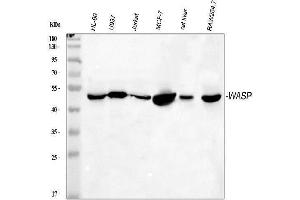 Western blot analysis of WASP using anti-WASP antibody (ABIN3043961).