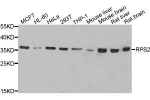 Western blot analysis of extracts of various cell lines, using RPS2 antibody. (RPS2 Antikörper  (AA 1-293))