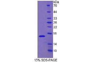 SDS-PAGE analysis of Mouse UPK1A Protein. (UPK1A Protein)