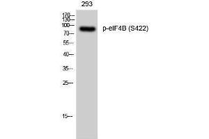 Western Blotting (WB) image for anti-Eukaryotic Translation Initiation Factor 4B (EIF4B) (pSer422) antibody (ABIN3182179) (EIF4B Antikörper  (pSer422))