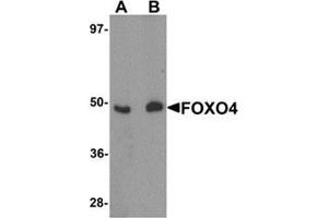 Western blot analysis of FOXO4 in HeLa cell lysate with FOXO4 antibody at (A) 0. (FOXO4 Antikörper  (N-Term))