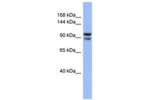 Image no. 1 for anti-Bobby Sox Homolog (BBX) (C-Term) antibody (ABIN6742855) (BBX Antikörper  (C-Term))