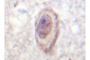 Immunohistochemistry analyzes of C-Raf antibody in paraffin-embedded human brain tissue. (RAF1 Antikörper)