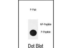 Dot Blot (DB) image for anti-Nuclear Factor of kappa Light Polypeptide Gene Enhancer in B-Cells Inhibitor, alpha (NFKBIA) (pSer32) antibody (ABIN650851)