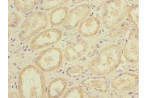 Immunohistochemistry of paraffin-embedded human kidney tissue using ABIN7150306 at dilution of 1:100 (DNA2 Antikörper  (AA 1-300))