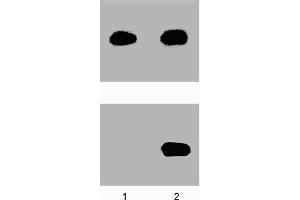 A431 cells were either left untreated (-) or treated (+) with 100 ng/ml EGF for 5 minutes at 37°C. (STAT5A Antikörper  (pTyr694))