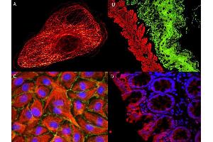 Immunofluorescence (IF) image for Goat anti-Rat IgG (Heavy & Light Chain) antibody (Atto 550) - Preadsorbed (ABIN965003)