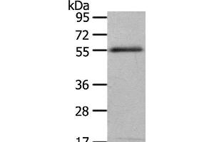 Western Blot analysis of 293T cell using ENPP7 Polyclonal Antibody at dilution of 1:700 (ENPP7 Antikörper)