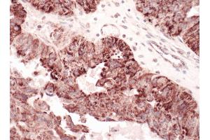 Immunohistochemistry (IHC) image for anti-Complement Component 1, Q Subcomponent Binding Protein (C1QBP) (AA 232-282) antibody (ABIN7453535) (C1QBP Antikörper  (AA 232-282))