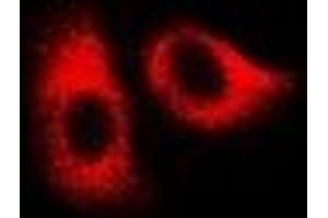 Immunofluorescent analysis of HSPA1L staining in U2OS cells. (HSPA1L Antikörper)