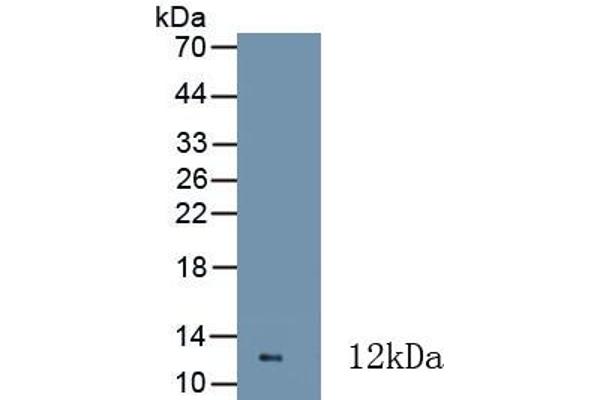 Calprotectin 抗体  (AA 1-114)