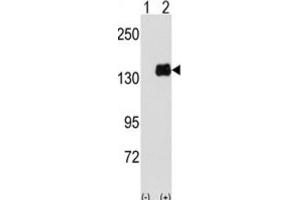 Western Blotting (WB) image for anti-Pumilio Homolog 1 (PUM1) antibody (ABIN3003296) (PUM1 Antikörper)