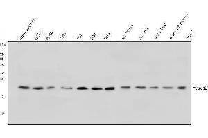 Western blot analysis of CDC42 using anti-CDC42 antibody (ABIN6719528).