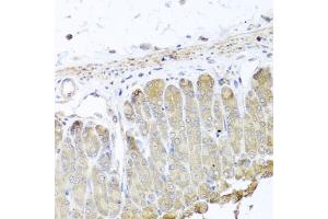 Immunohistochemistry of paraffin-embedded mouse stomach using IRS2 antibody.