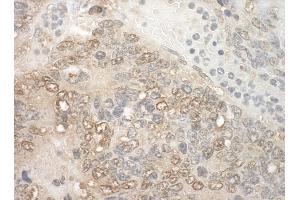 Immunohistochemistry (IHC) image for anti-Zinc Finger, CCHC Domain Containing 11 (ZCCHC11) (AA 250-300) antibody (ABIN7448876) (ZCCHC11 Antikörper  (AA 250-300))