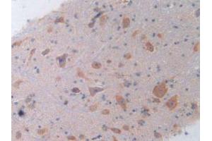IHC-P analysis of Rat Spinal Cord Tissue, with DAB staining. (IL-4 Antikörper  (AA 61-111))