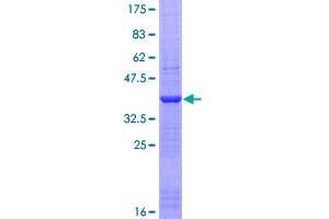 KHDRBS1 Protein (AA 176-275) (GST tag)