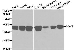 Western blot analysis of extracts of various cell lines, using SGK1 antibody. (SGK1 Antikörper  (AA 172-431))