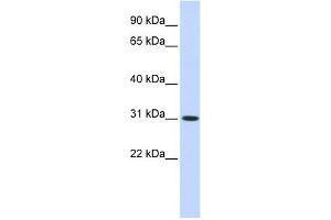 CYB5D2 antibody used at 1 ug/ml to detect target protein.