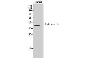 Western Blotting (WB) image for anti-Doublecortin (DCX) (Ser30) antibody (ABIN3184351) (Doublecortin Antikörper  (Ser30))