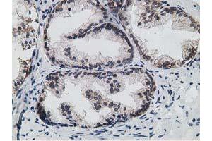 Immunohistochemical staining of paraffin-embedded Human prostate tissue using anti-HPGD mouse monoclonal antibody. (HPGD Antikörper)