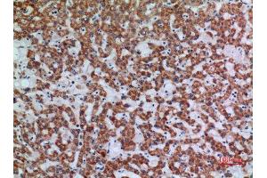 Immunohistochemistry (IHC) analysis of paraffin-embedded Human Liver, antibody was diluted at 1:100. (APAF1 Antikörper  (Internal Region))