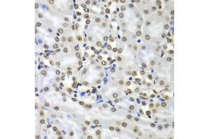 Immunohistochemistry of paraffin-embedded mouse kidney using SEPT7 antibody (ABIN5974146) at dilution of 1/100 (40x lens). (Septin 7 Antikörper)