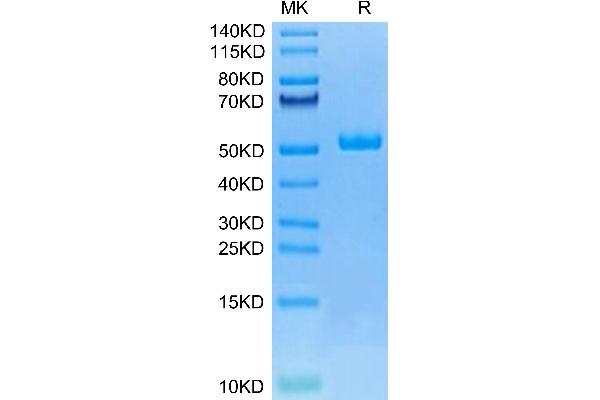 WFDC2 Protein (AA 28-124) (Fc Tag)