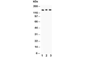 Western blot testing of Insulin Receptor antibody and Lane 1:  rat kidney (Insulin Receptor Antikörper  (AA 1353-1372))
